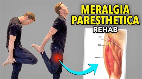 meralgia paresthetica pelvic compression test|best exercise for meralgia paresthetica.